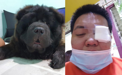 超狂黑色鬆獅，撞飛主人眼角膜？