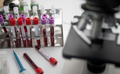 武漢肺炎疫苗有望？WHO：最快明年初投入使用...